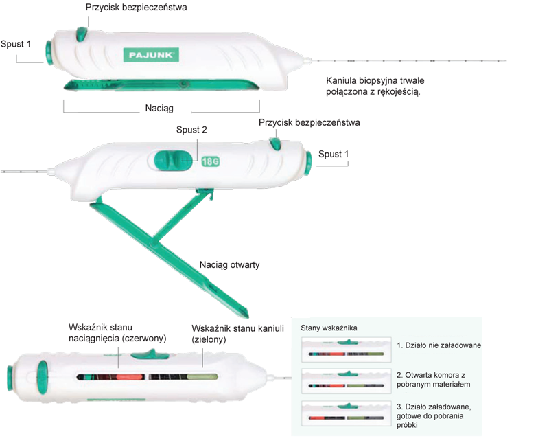 biopsja gruboigłowa CoreCut